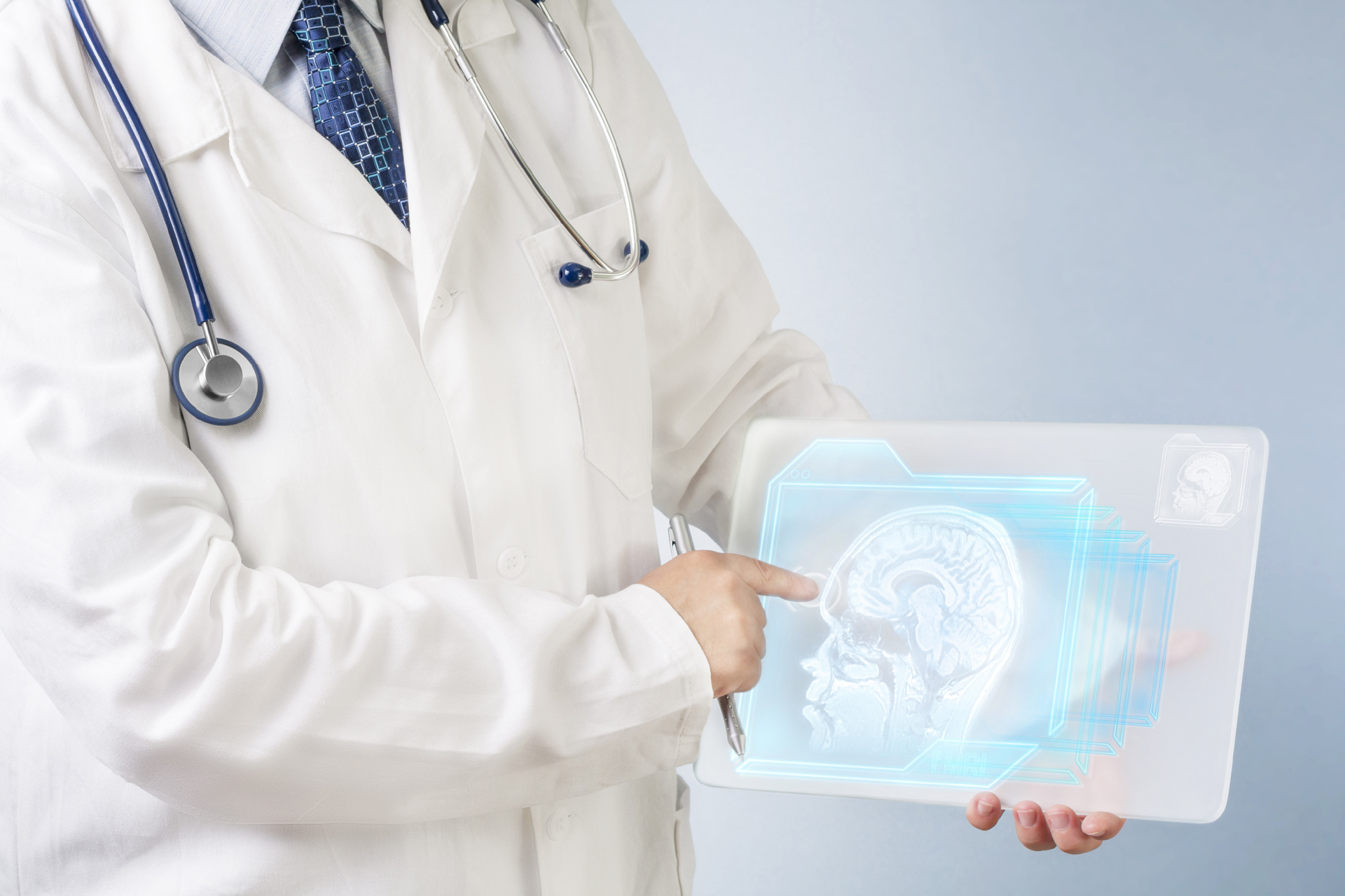 Doctor holding a picture from head MRI